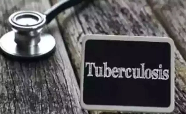 West Bengal health department to help private hospitals in Tb fights