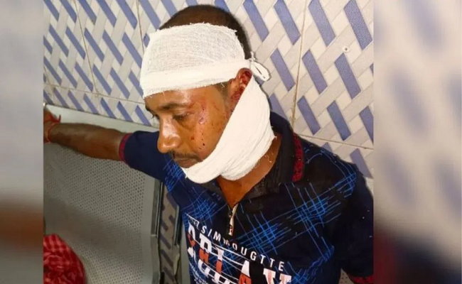 Violence amidst panchayat elections, Murshidabad reports 3 fatalities