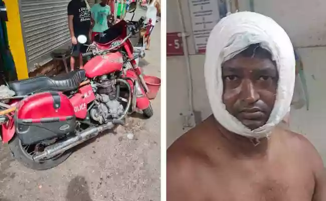 नशेड़ी ने फोड़ा पुलिसकर्मी का सर, शोभाबाजार में गश्त के दौरान हुआ हमला