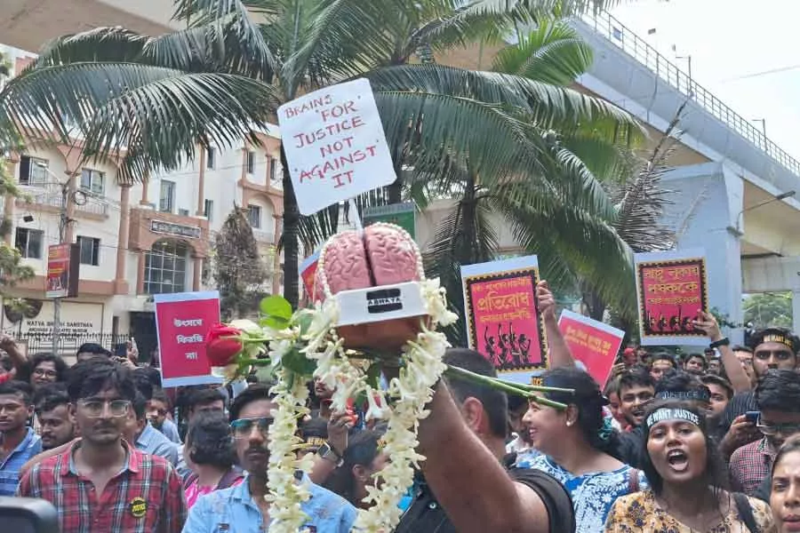 अब ब्रेन का प्रतीक लेकर डॉक्टरों ने किया स्वास्थ्य भवन की ओर कूच, आंदोलन जारी रखने का ऐलान