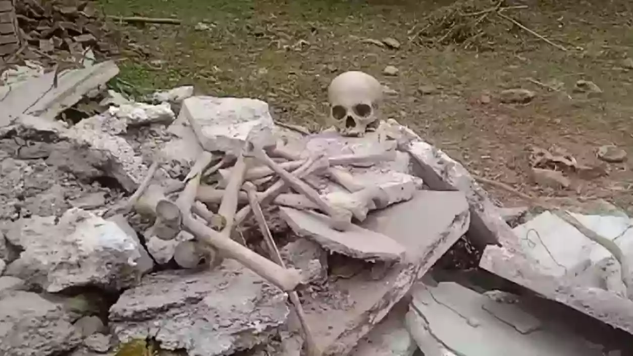 Human skull and necklace found at Belghoria ID hospital morgue