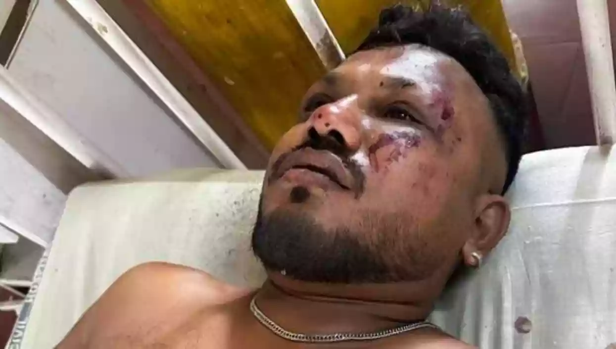 Passenger in seat 11A survives Ahmedabad crash, says brother still missing