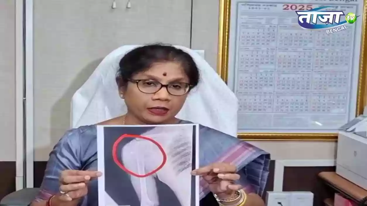 Shashi Panja says 'BJP's violent face showing ahead of polls' after TMC leader shot in Cooch Behar | Watch