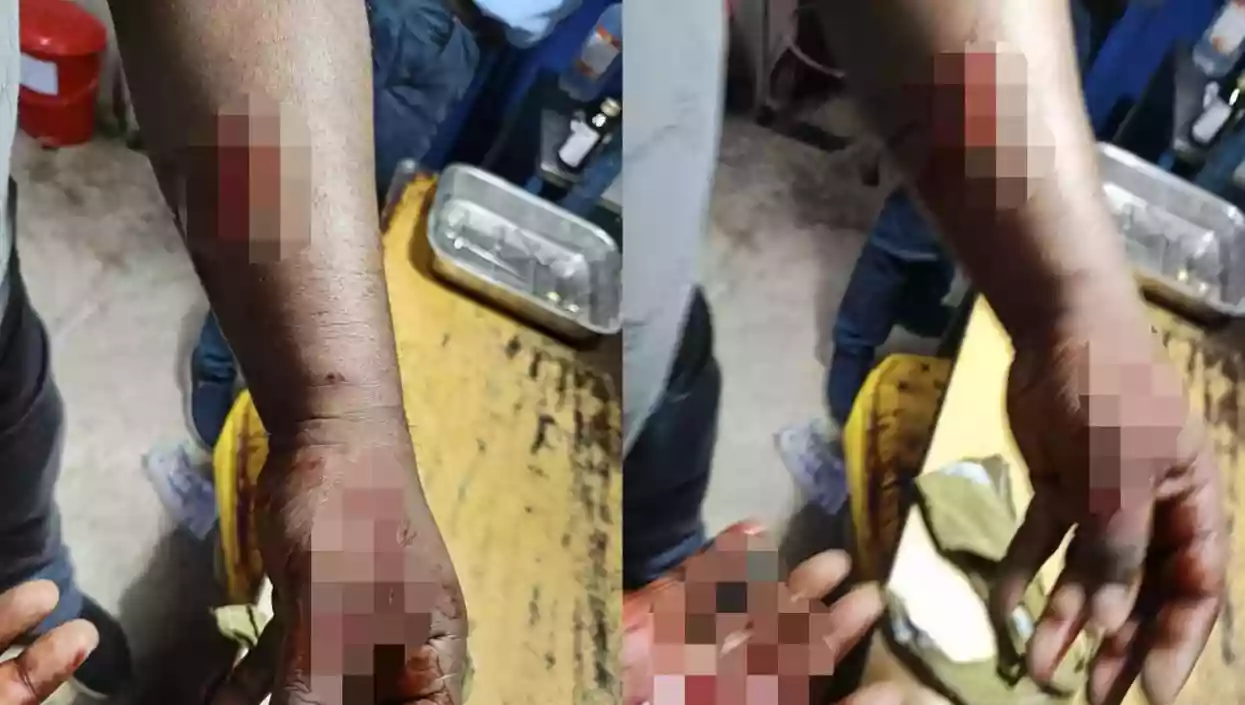 Passenger attacked in Ranaghat local after protesting against armed youths
