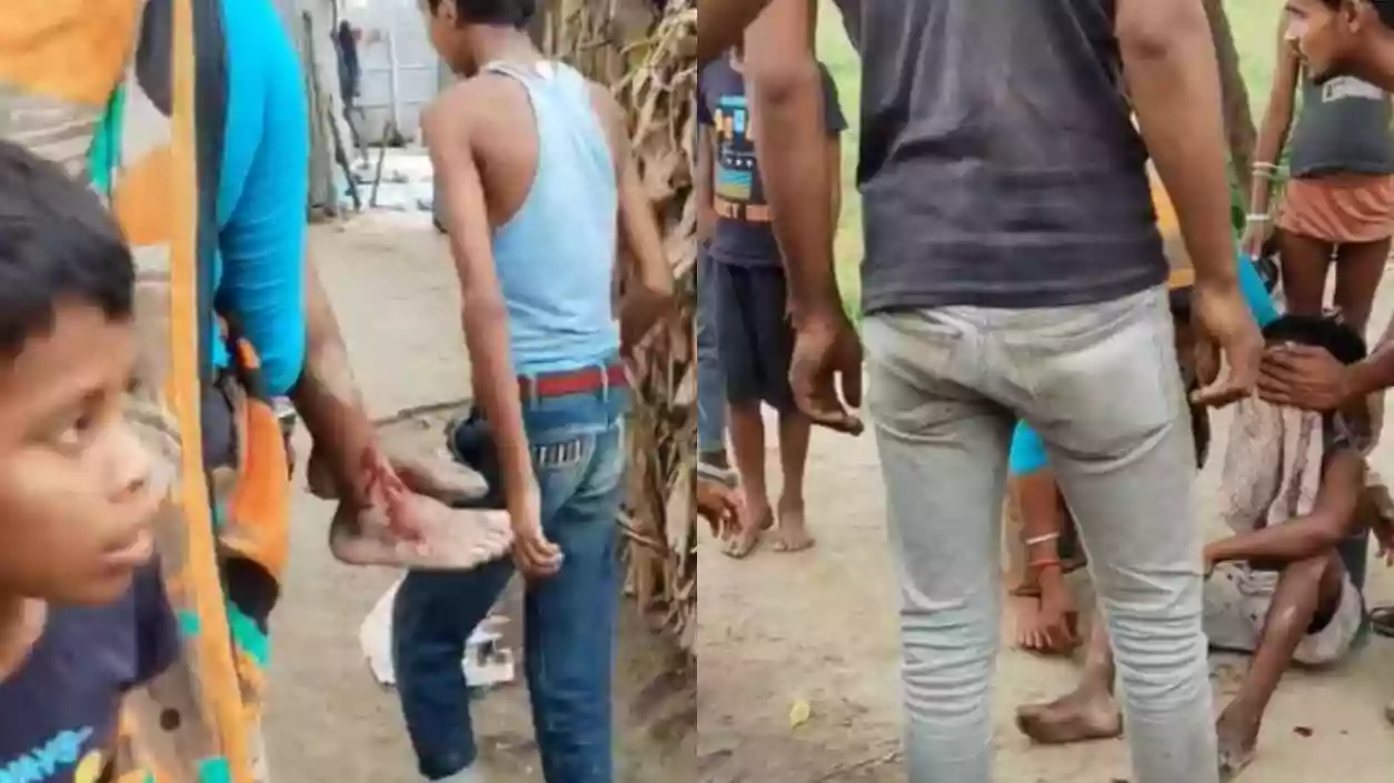 Child injured after ‘bomb’ explodes while mistaking it for a ball in Uttar Dinajpur